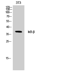IKappaB-Beta Polyclonal Antibody – Figure 1 of 1