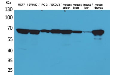 Lamin B1 Polyclonal Antibody – Figure 1 of 1