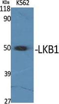 LKB1 Polyclonal Antibody – Figure 1 of 1