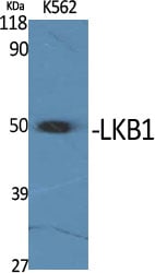 LKB1 Polyclonal Antibody – Figure 1 of 1