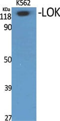 LOK Polyclonal Antibody – Figure 1 of 1