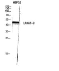 LPAAT-Theta Polyclonal Antibody – Figure 1 of 1