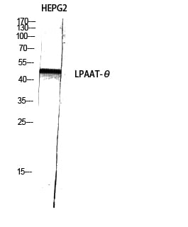 LPAAT-Theta Polyclonal Antibody – Figure 1 of 1
