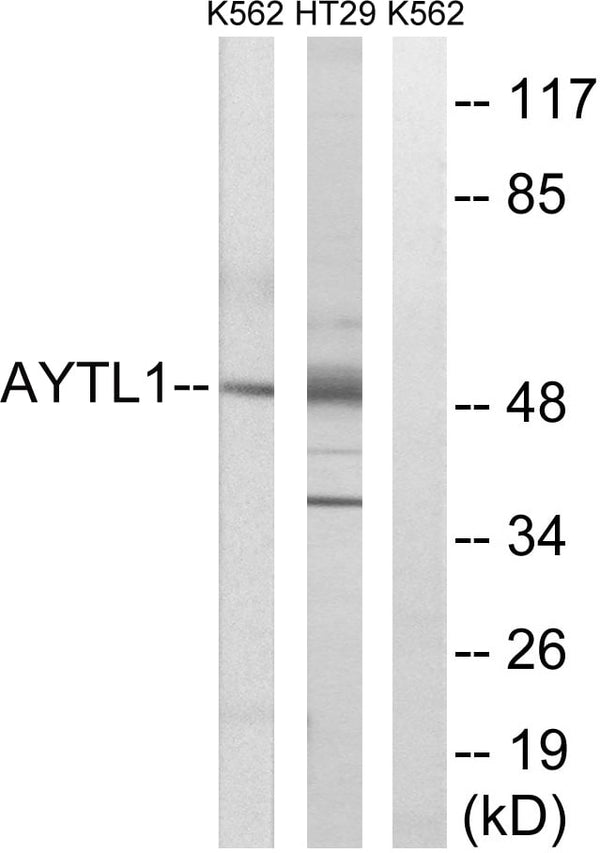 LPCAT2 Polyclonal Antibody – Figure 1 of 1