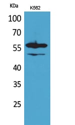 Lyn Polyclonal Antibody – Figure 1 of 1