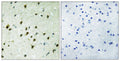 Mad 4 Polyclonal Antibody – Figure 1 of 1
