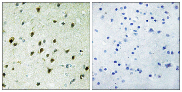 Mad 4 Polyclonal Antibody – Figure 1 of 1