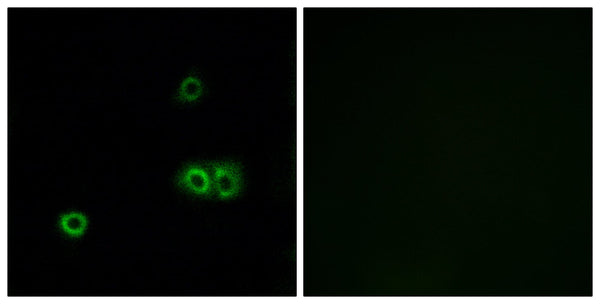 MARCH5 Polyclonal Antibody – Figure 1 of 1