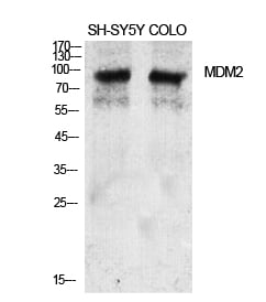 MDM2 Polyclonal Antibody – Figure 1 of 1