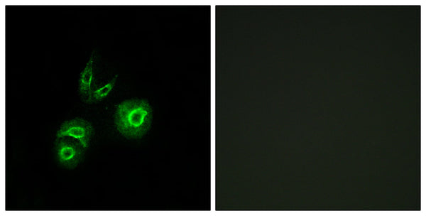 Met Polyclonal Antibody – Figure 1 of 1