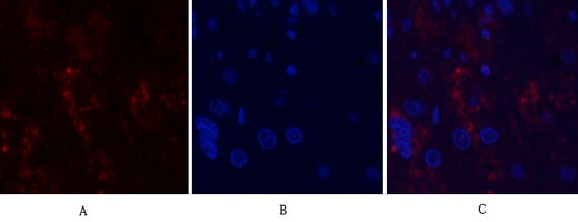 MMP-9 Polyclonal Antibody – Figure 1 of 1