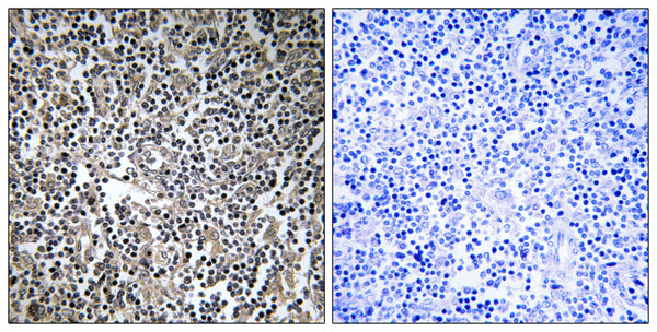 M-RIP Polyclonal Antibody – Figure 1 of 1