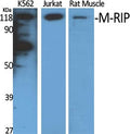 M-RIP Polyclonal Antibody – Figure 1 of 1