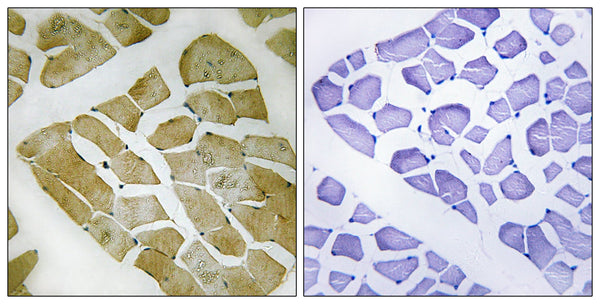 MYH4 Polyclonal Antibody – Figure 1 of 1