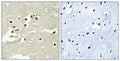 NCoA-5 Polyclonal Antibody – Figure 1 of 1