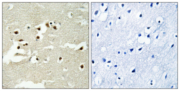 NCoA-5 Polyclonal Antibody – Figure 1 of 1