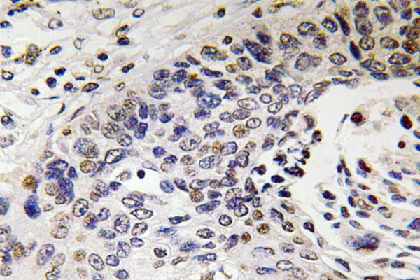 NF-H Polyclonal Antibody – Figure 1 of 1