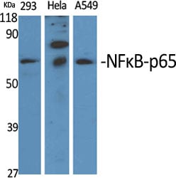 NFKappaB-p65 Polyclonal Antibody – Figure 1 of 1