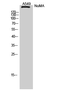 NuMA Polyclonal Antibody – Figure 1 of 1