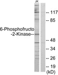 PFK-2 car Polyclonal Antibody – Figure 1 of 1