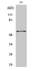 PFK-2 car Polyclonal Antibody – Figure 1 of 1