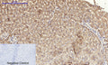 PI 3-kinase p110 Alpha Polyclonal Antibody – Figure 1 of 1
