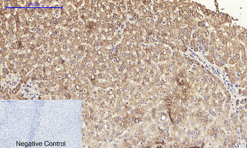 PI 3-kinase p110 Alpha Polyclonal Antibody – Figure 1 of 1