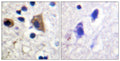 PIP5KIII Polyclonal Antibody – Figure 1 of 1