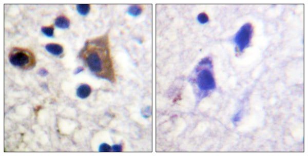 PIP5KIII Polyclonal Antibody – Figure 1 of 1