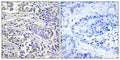 PLC-XD1 Polyclonal Antibody – Figure 1 of 1
