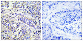 PLC-XD1 Polyclonal Antibody – Figure 1 of 1