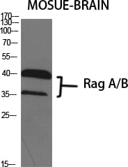 Rag A/B Polyclonal Antibody – Figure 1 of 1