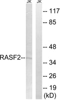 RASSF2 Polyclonal Antibody – Figure 1 of 1