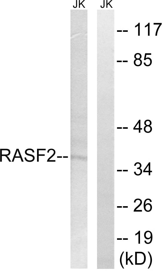 RASSF2 Polyclonal Antibody – Figure 1 of 1