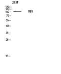 Rb Polyclonal Antibody – Figure 1 of 1