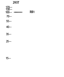 Rb Polyclonal Antibody – Figure 1 of 1