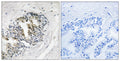 Ribosomal Protein LP2 Polyclonal Antibody – Figure 1 of 1