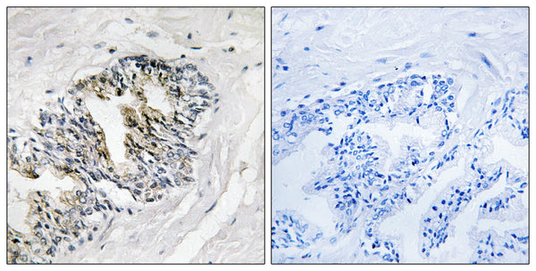 Ribosomal Protein LP2 Polyclonal Antibody – Figure 1 of 1