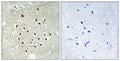 Ribosomal Protein S19BP Polyclonal Antibody – Figure 1 of 1