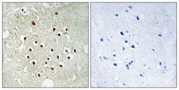 Ribosomal Protein S19BP Polyclonal Antibody – Figure 1 of 1