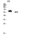 RIP2 Polyclonal Antibody – Figure 1 of 1
