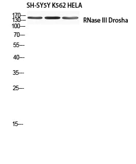 RNase III Drosha Polyclonal Antibody – Figure 1 of 1