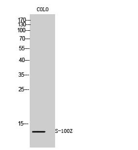 S-100Z Polyclonal Antibody – Figure 1 of 1