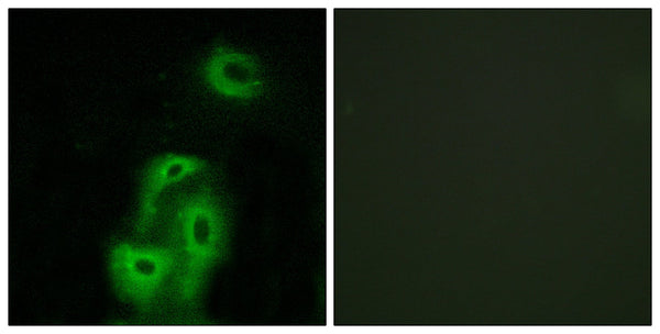 SR-2A Polyclonal Antibody – Figure 1 of 1