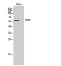 TPH2 Polyclonal Antibody – Figure 1 of 1
