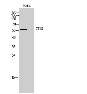 TPH2 Polyclonal Antibody – Figure 1 of 1
