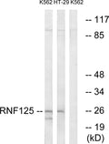 TRAC-1 Polyclonal Antibody – Figure 1 of 1