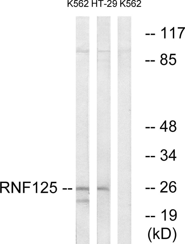 TRAC-1 Polyclonal Antibody – Figure 1 of 1