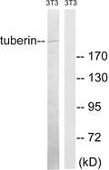 Tuberin Polyclonal Antibody – Figure 1 of 1