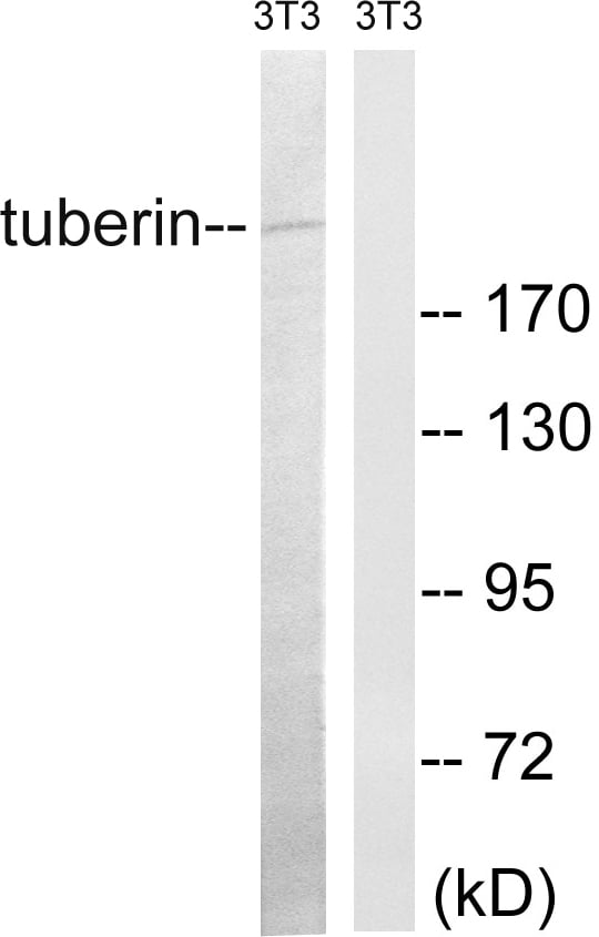 Tuberin Polyclonal Antibody – Figure 1 of 1